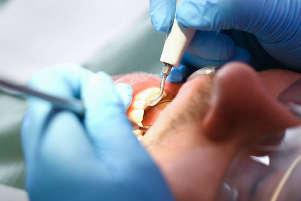 Best Emergency Gum Pain Relief  in Union City, OK