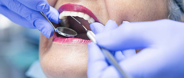 Best Emergency Dental Filling Replacement  in Union City, OK